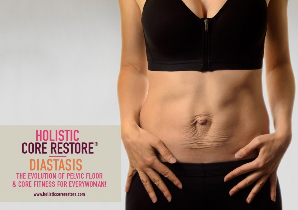 Diastasis Recti Rehab Programme, Horsham, West Sussex